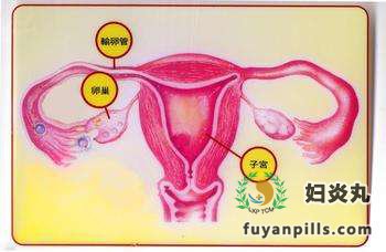 输卵管炎导致女性不孕怎么