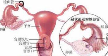输卵管炎对做人工受孕有影响吗