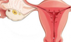 宫颈糜烂为什么会引起出血？