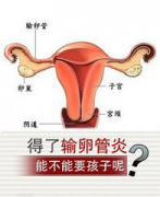 什么原因引起女性输卵管炎？