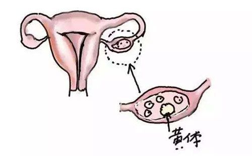 子宫内膜复杂性增生