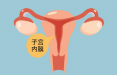 哪些中成药能够治疗子宫内膜炎?
