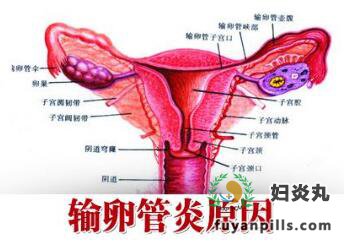 输卵管炎引起不孕的原因