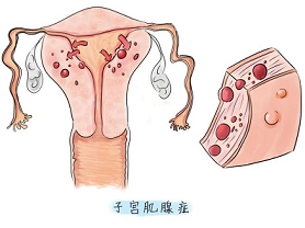 下载