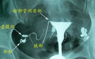 b404656804cd787091c11bad71b6a068