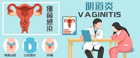 阴道炎会导致输卵管堵塞吗?