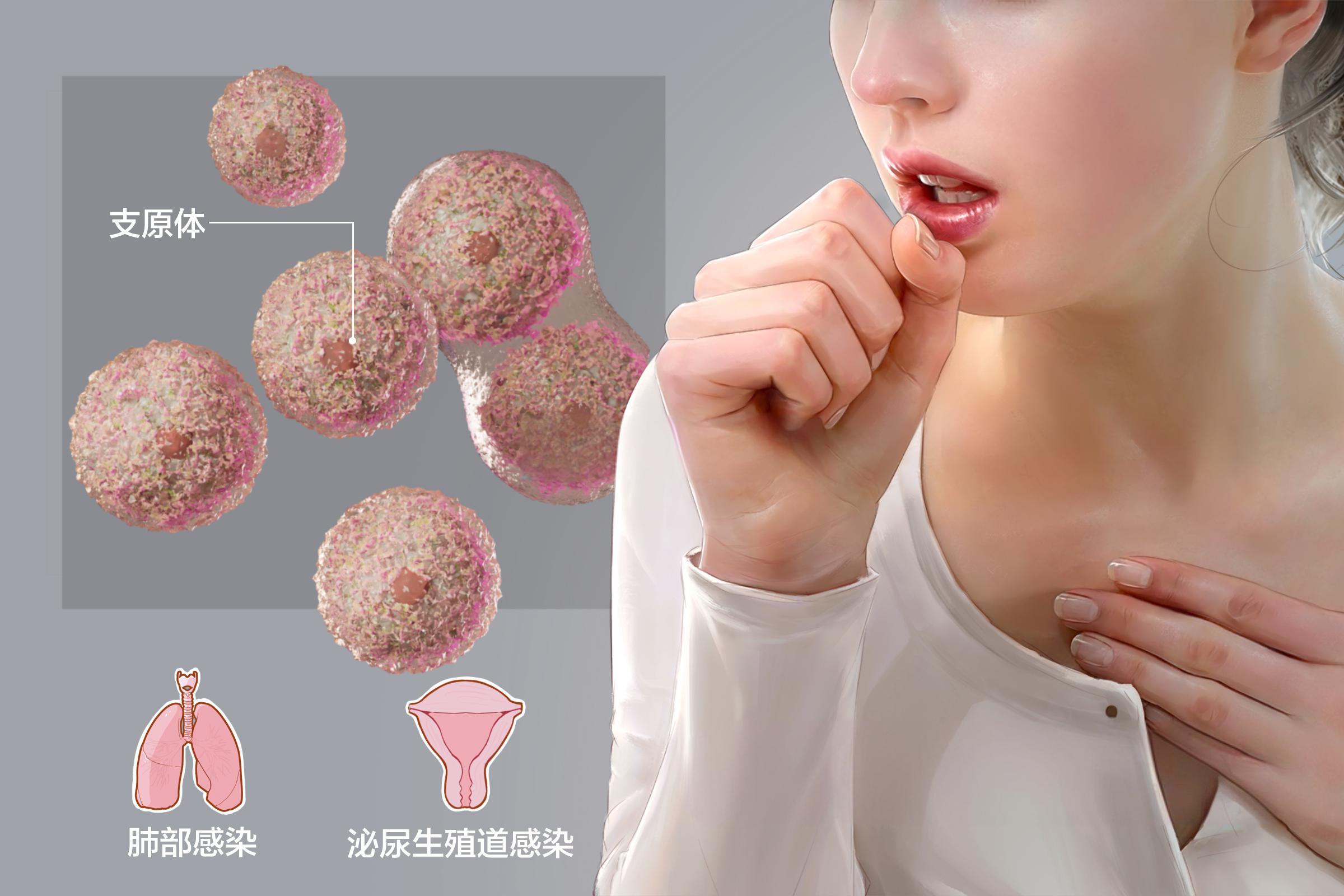 女性支原体阳性没有症状需要治疗吗？这份指南请收好