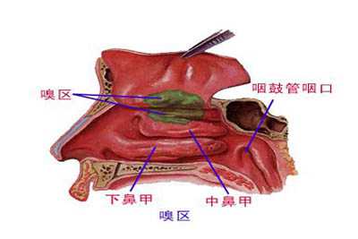 鼻炎