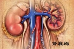 长期吃止痛药  竟然吃出肾衰竭