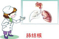 肺结核春季高发 一年四季均可传染