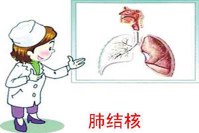 肺结核