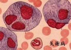 罕见戈谢病 让他的脾脏几乎占据了整个腹腔