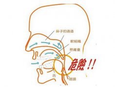睡觉睡出“人命” 许是睡眠呼吸暂停综合症所致