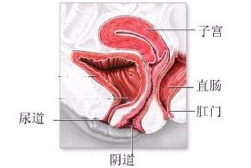 淋菌性阴道炎