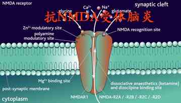 抗NMDA受体脑炎