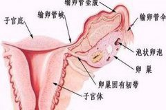 输卵管中段梗阻 吻合术治疗易宫外孕