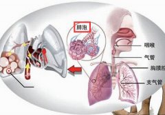 疯狂K歌吼破肺大泡 若现胸闷气短需警觉
