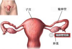 输卵管弯曲是否能怀孕 依据程度轻重