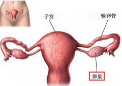 警惕！卵巢肿瘤也有可能发生在幼女身上