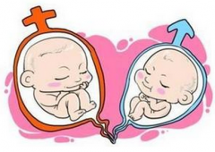 因双子宫 她结婚多年一直不孕