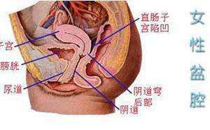 妇炎丸能治盆腔炎吗