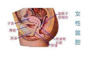 妇炎丸能治疗盆腔炎吗,妇炎丸治疗盆腔炎效果如何