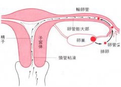 怎么判断输卵管不通？