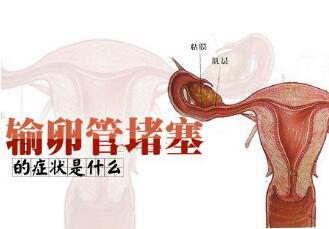 女性输卵管堵塞的症状是什么