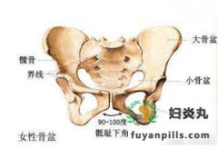 妇女盆腔疼痛的这些原因 你知道吗