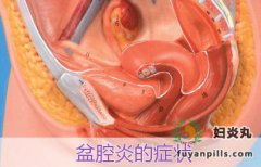 白带增多、腰疼是什么情况