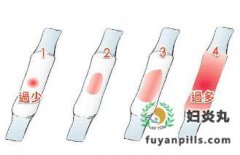 月经量过少是病吗，有什么影响?怎么调理?