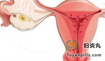 妇炎丸治疗子宫内膜增厚案例