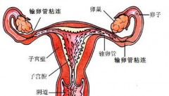 输卵管粘连吃什么药好？