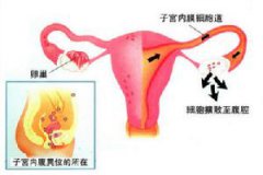 保养子宫从早餐6元素开始