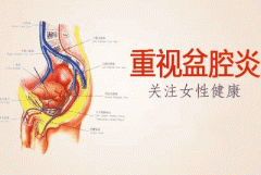 盆腔积液的运动疗法，你知道多少？