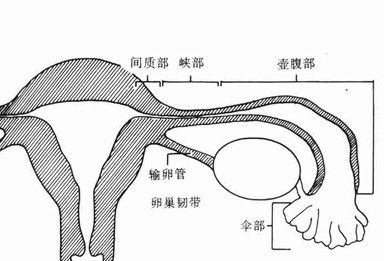 双侧输卵管积水