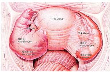 子宫腺肌症