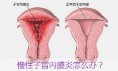 中医辨证治疗子宫内膜炎