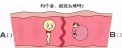 生活中有哪些方法可以疏通输卵管