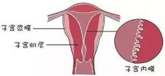 子宫内膜厚会导致女性不孕吗?该如何治疗?
