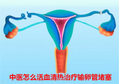中医怎么活血清热治疗输卵管堵塞