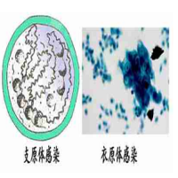 什么情况下需要检查支原体衣原体